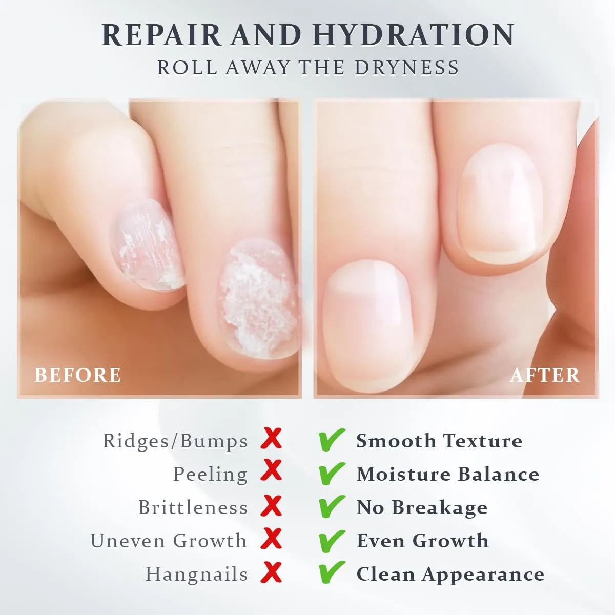 Vanilla Almond Repair & Hydrate Cuticle & Nail Oil for Growth and Strength Serum w/Coconut MCT, Jojoba & Rosehip for Dry Nails, Nail Hardener for Damaged Nails - Bag Charms for Handbags